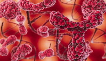 Warum sollten Krebspatienten die Sauna meiden? Wichtige Informationen